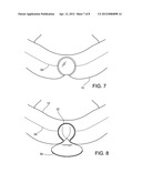 BODY-SHAPING INTIMACY GARMENT diagram and image