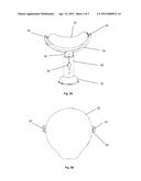 CERVICAL SPINE AND HEAD SUPPORTING DEVICE diagram and image