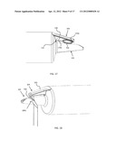 Pump Nozzle With Balloon-Tying Element diagram and image