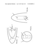 STRAY LIGHT BAFFLES FOR A CONFORMAL DOME WITH ARCH CORRECTOR OPTICS diagram and image