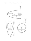 STRAY LIGHT BAFFLES FOR A CONFORMAL DOME WITH ARCH CORRECTOR OPTICS diagram and image