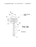 Lever enhanced pedaling system with wrap around chain propulsion system diagram and image