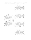 Non Powered Concepts for a Wire Frame of Fluid Filled Lenses diagram and image