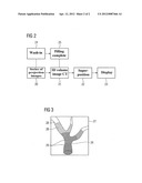 X-ray Image Recording Method diagram and image