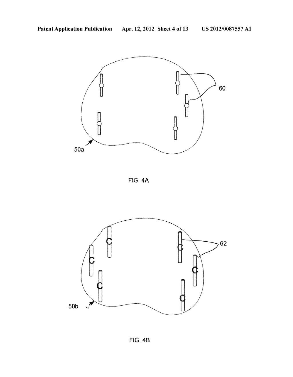 BIOPSY PLANNING AND DISPLAY APPARATUS - diagram, schematic, and image 05