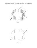 BIOPSY PLANNING AND DISPLAY APPARATUS diagram and image