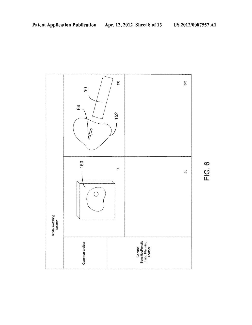 BIOPSY PLANNING AND DISPLAY APPARATUS - diagram, schematic, and image 09