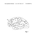 DEVICE AND METHOD FOR CEREBRAL LOCATION ASSISTANCE diagram and image