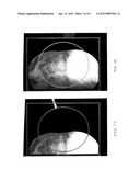 Imaging System and Method for Surgical and Interventional Medical     Procedures diagram and image