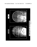 Imaging System and Method for Surgical and Interventional Medical     Procedures diagram and image