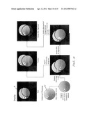 Imaging System and Method for Surgical and Interventional Medical     Procedures diagram and image