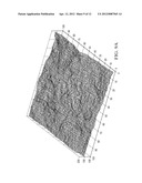 METHOD AND APPARATUS FOR ENHANCING REPRESENTATIONS OF MICRO-CALCIFICATIONS     IN A DIGITAL MAMMOGRAM IMAGE diagram and image