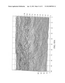 METHOD AND APPARATUS FOR ENHANCING REPRESENTATIONS OF MICRO-CALCIFICATIONS     IN A DIGITAL MAMMOGRAM IMAGE diagram and image