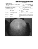 Hair growth agent having a platelet dry powder diagram and image