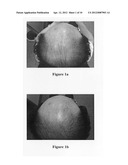 Hair growth agent having a platelet dry powder diagram and image