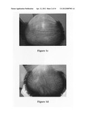 Hair growth agent having a platelet dry powder diagram and image