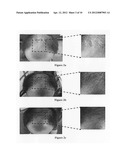 Hair growth agent having a platelet dry powder diagram and image