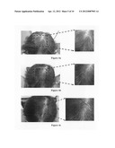 Hair growth agent having a platelet dry powder diagram and image