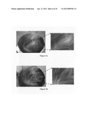 Hair growth agent having a platelet dry powder diagram and image