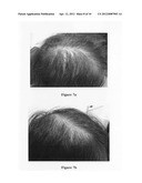 Hair growth agent having a platelet dry powder diagram and image