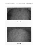 Hair growth agent having a platelet dry powder diagram and image