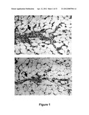 Use Of 2,5-Dihydroxybenzene Compounds And Derivatives For The Treatment Of     Skin Cancer diagram and image