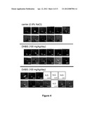 Use Of 2,5-Dihydroxybenzene Compounds And Derivatives For The Treatment Of     Skin Cancer diagram and image