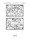 Use Of 2,5-Dihydroxybenzene Compounds And Derivatives For The Treatment Of     Skin Cancer diagram and image