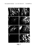 METHOD FOR THE TREATMENT OF INFLAMMATORY DISORDERS diagram and image