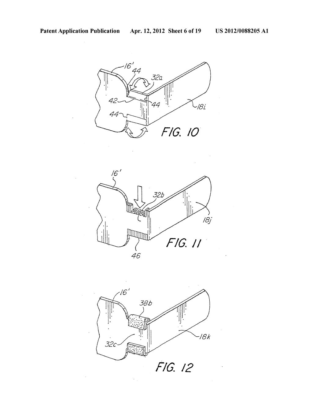 DENTAL BITE BLOCK - diagram, schematic, and image 07