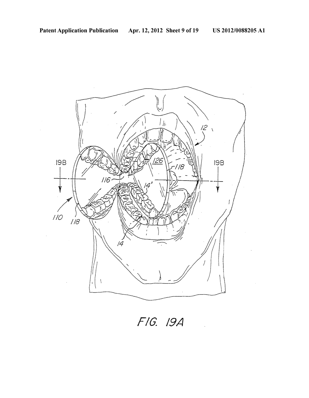 DENTAL BITE BLOCK - diagram, schematic, and image 10