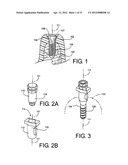 Method for Defining a Dental Framework Design Volume diagram and image