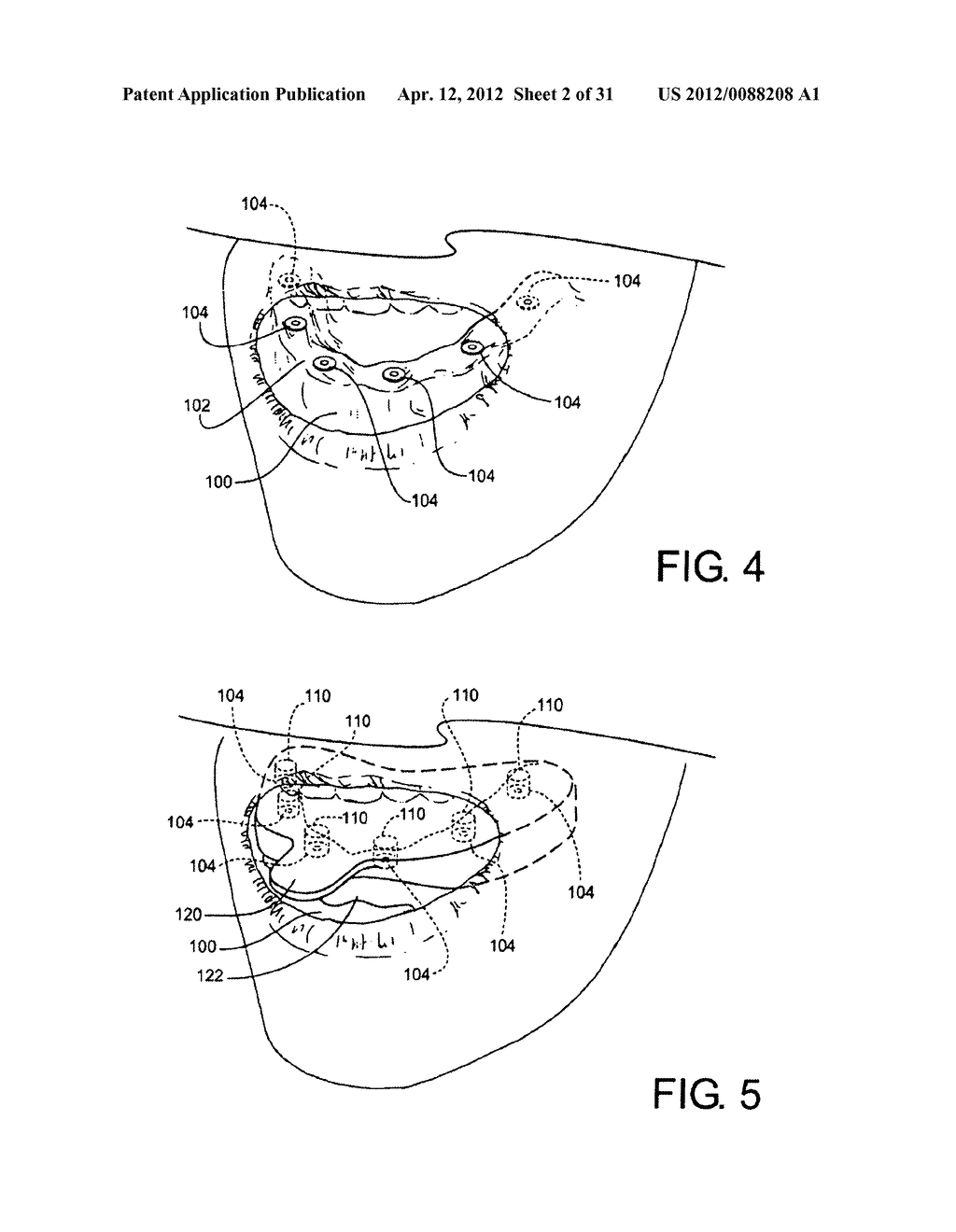 Method for Defining a Dental Framework Design Volume - diagram, schematic, and image 03