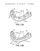 Method for Defining a Dental Framework Design Volume diagram and image