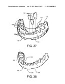 Method for Defining a Dental Framework Design Volume diagram and image