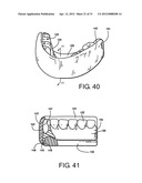 Method for Defining a Dental Framework Design Volume diagram and image