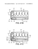 Method for Defining a Dental Framework Design Volume diagram and image