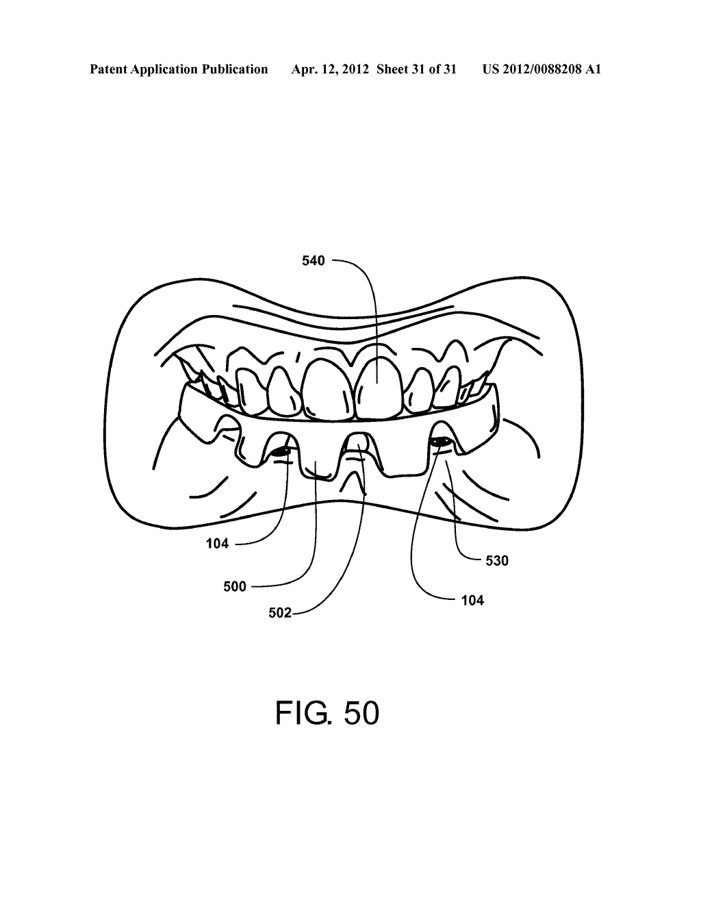 Method for Defining a Dental Framework Design Volume - diagram, schematic, and image 32