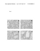 METHOD OF DIAGNOSING RENAL DISORDERS diagram and image