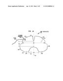 BOWEL PACKING DEVICE HAVING A TETHER diagram and image