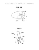 Methods and Devices for Placement of an Intra-Abdominal or Intra-Thoracic     Appliance Through a Natural Body Orifice diagram and image