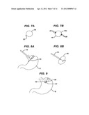 Methods and Devices for Placement of an Intra-Abdominal or Intra-Thoracic     Appliance Through a Natural Body Orifice diagram and image