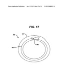 Methods and Devices for Placement of an Intra-Abdominal or Intra-Thoracic     Appliance Through a Natural Body Orifice diagram and image