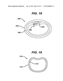 Methods and Devices for Placement of an Intra-Abdominal or Intra-Thoracic     Appliance Through a Natural Body Orifice diagram and image