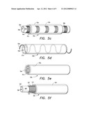 PARAMETER-SENSING ENDOTRACHEAL TUBE diagram and image