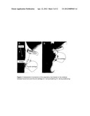 MEASUREMENT SYSTEM FOR EVALUATING THE SWALLOWING PROCESS AND/OR FOR     DETECTING ASPIRATION diagram and image