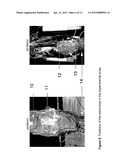 MEASUREMENT SYSTEM FOR EVALUATING THE SWALLOWING PROCESS AND/OR FOR     DETECTING ASPIRATION diagram and image