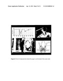 MEASUREMENT SYSTEM FOR EVALUATING THE SWALLOWING PROCESS AND/OR FOR     DETECTING ASPIRATION diagram and image