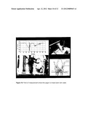 MEASUREMENT SYSTEM FOR EVALUATING THE SWALLOWING PROCESS AND/OR FOR     DETECTING ASPIRATION diagram and image