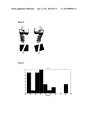 HEAD TILT RESPONSE diagram and image